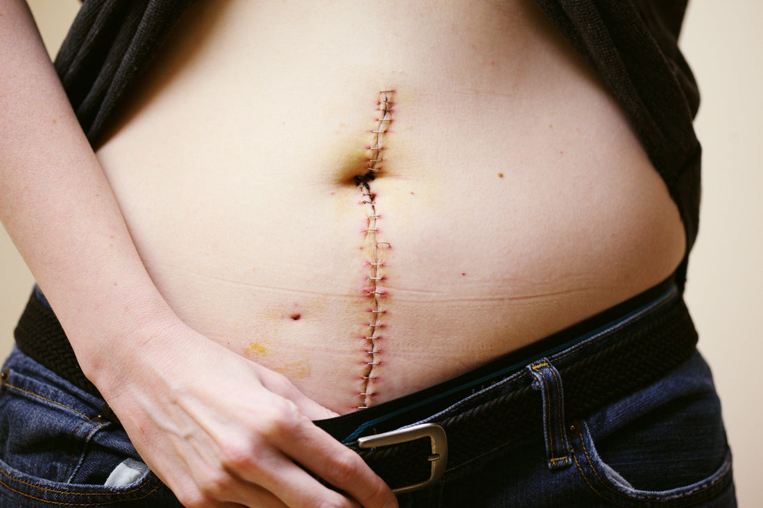 CBD in Gastroenterology – Gut health and digestive support at 24Supplements.